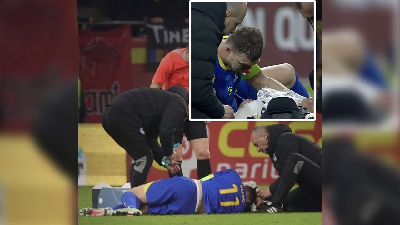 Dzeko’nun Kâbus Gecesi! Yüzü Kan Revan İçinde, Kariyeri Tehlikede Mi?