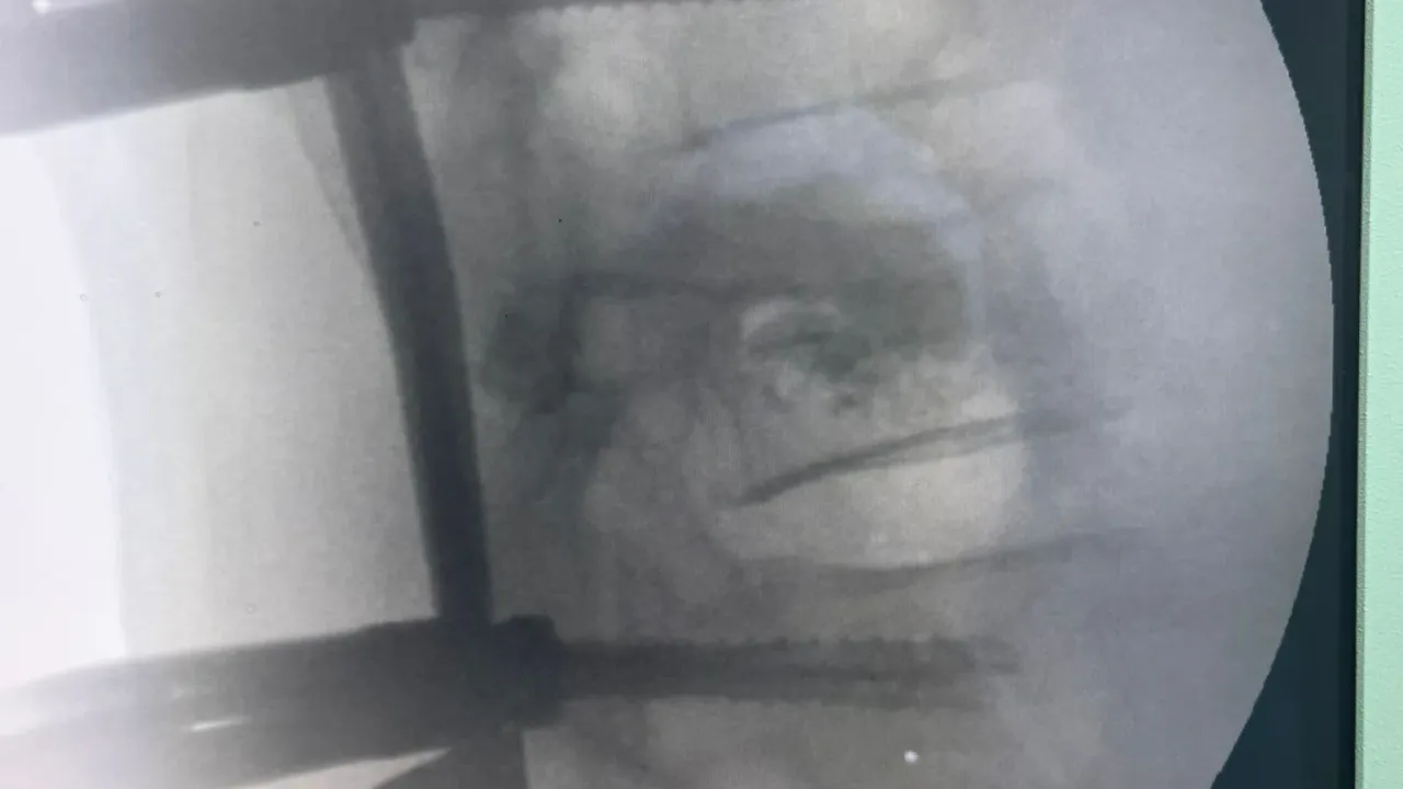 Trabzon’da Vida Mucizesi: Hasta Yeniden Doğdu!